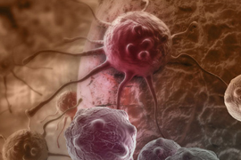 Նոր թեստը կարող է կանխատեսել քաղցկեղը դրա զարգացումից 10 տարի առաջ. tert.am
