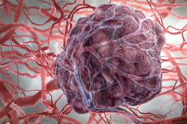 ԱՄՆ-ում փորձարկել են աղիների քաղցկեղի՝ ռադիոակտիվ գնդակների միջոցով բուժման նոր մեթոդը. news.am