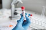 Новые клинические исследования вакцины против ВИЧ