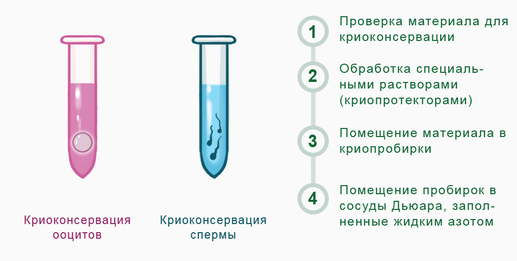 Заморозка Яйцеклеток Стоимость По Москве